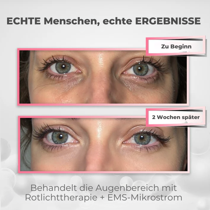 HerbaEyes – strahlende Augen